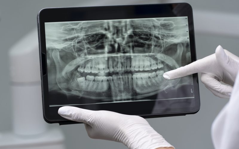 Scanarea digitală – beneficii pentru pacient Scanarea digitală – beneficii pentru pacient